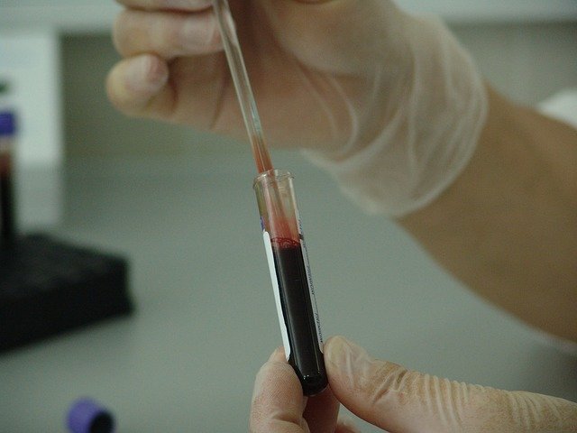 Забор анализа крови на коагулограмму thumbnail